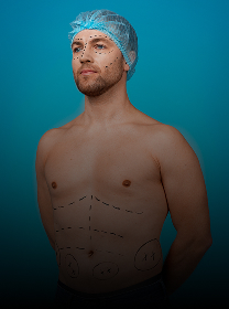 Body Contouring Expertise